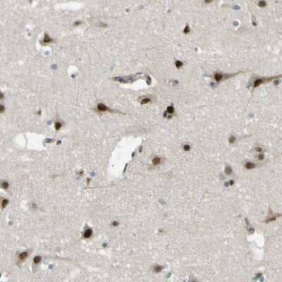 Immunohistochemistry-Paraffin: JHDM1D Antibody [NBP1-81382]