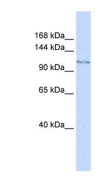 Western Blot: JHDM1D Antibody [NBP1-79714]