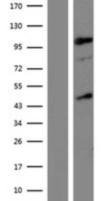 Western Blot: JHDM1D Overexpression Lysate [NBP2-06204]