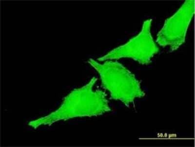 Immunocytochemistry/ Immunofluorescence: JIK Antibody (2B8) [H00051347-M08]