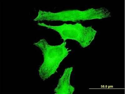 Immunocytochemistry/ Immunofluorescence: JIK Antibody (3B2) [H00051347-M07]