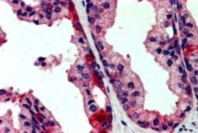 Immunohistochemistry: JIK Antibody [NB300-815]