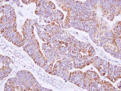 Immunohistochemistry-Paraffin: JIK Antibody [NBP1-32181]