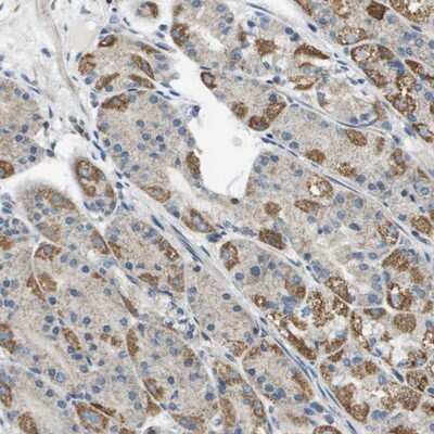 Immunohistochemistry-Paraffin: JIK Antibody [NBP1-84988]