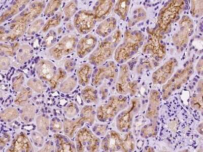 Immunohistochemistry-Paraffin: JIK Antibody [NBP2-97320]