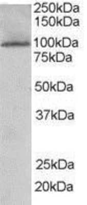 Western Blot: JIK Antibody [NB300-815]