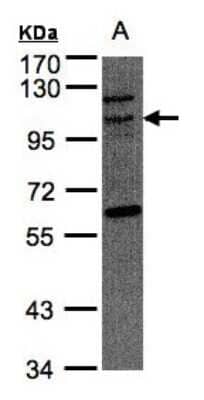 Western Blot: JIK Antibody [NBP1-32181]