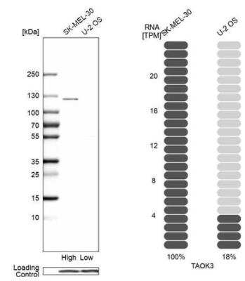 Western Blot: JIK Antibody [NBP1-84988]