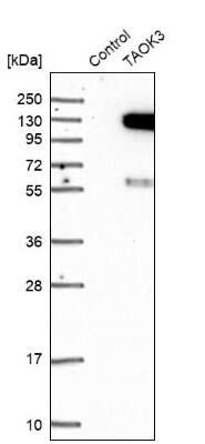 Western Blot: JIK Antibody [NBP1-84988]