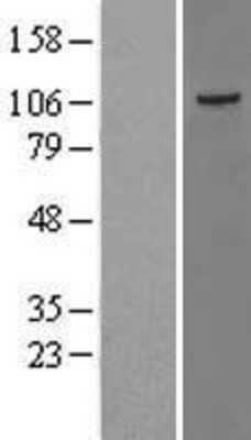 Western Blot: JIK Overexpression Lysate [NBL1-16698]