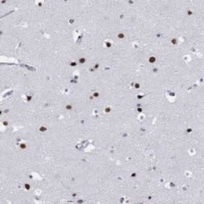 Immunohistochemistry-Paraffin: JIP1 Antibody [NBP3-17726]