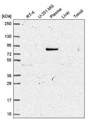 Western Blot: JIP1 Antibody [NBP2-58545]