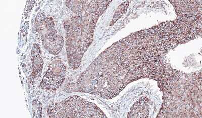 Immunohistochemistry-Paraffin: JIP2 Antibody [NBP1-31411]