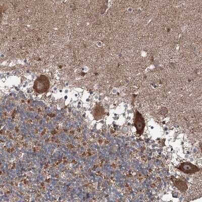 Immunohistochemistry-Paraffin: JIP2 Antibody [NBP1-89638]