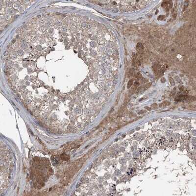 Immunohistochemistry-Paraffin: JIP2 Antibody [NBP1-89638]