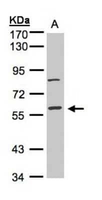 Western Blot: JIP2 Antibody [NBP1-31411]