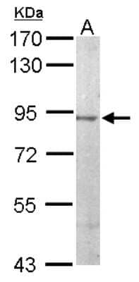 Western Blot: JIP2 Antibody [NBP1-33035]