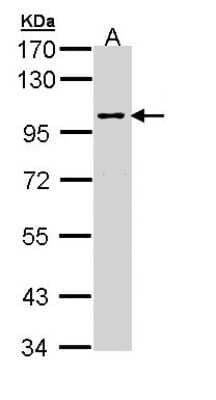 Western Blot: JIP2 Antibody [NBP1-33035]