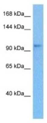 Western Blot: JIP2 Antibody [NBP3-10000]