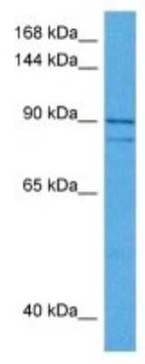 Western Blot: JIP2 Antibody [NBP3-10078]