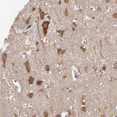 Immunohistochemistry-Paraffin: JM4 Antibody [NBP1-87886]