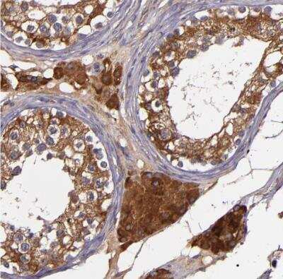 Immunohistochemistry-Paraffin: JM4 Antibody [NBP1-87886]