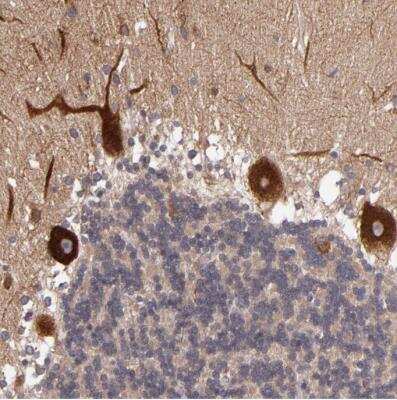 Immunohistochemistry-Paraffin: JM4 Antibody [NBP1-87886]