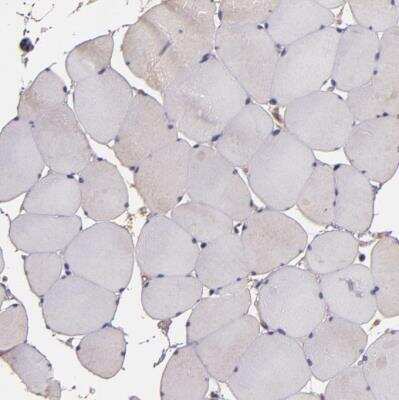 Immunohistochemistry-Paraffin: JM4 Antibody [NBP1-87886]