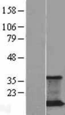 Western Blot: JM4 Overexpression Lysate [NBL1-14721]