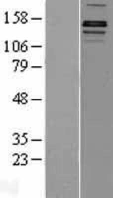 Western Blot: Lysine (K)-specific Demethylase 3A/KDM3A/JMJD1A Overexpression Lysate [NBP2-11469]