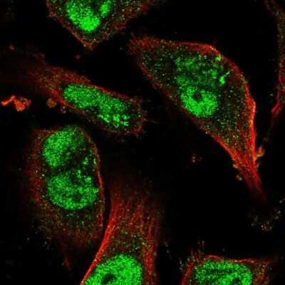 Immunocytochemistry/ Immunofluorescence: JMJD1B Antibody [NBP2-58143]