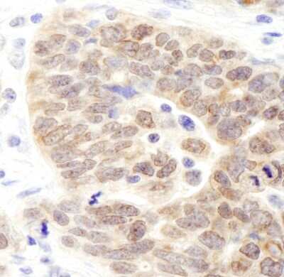 Immunohistochemistry: JMJD1B Antibody [NB110-38879]