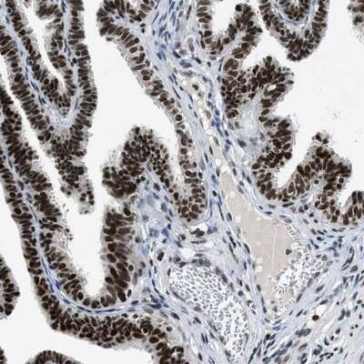 Immunohistochemistry-Paraffin: JMJD1B Antibody [NBP1-88256]
