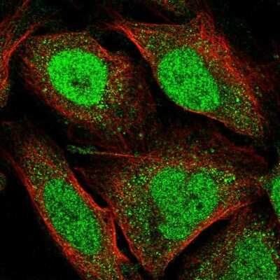 Immunocytochemistry/ Immunofluorescence: JMJD1C Antibody [NBP2-33777]