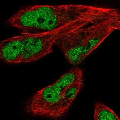 Immunocytochemistry/ Immunofluorescence: JMJD1C Antibody [NBP2-55700]