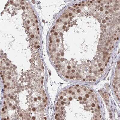 Immunohistochemistry-Paraffin: JMJD1C Antibody [NBP2-33777]