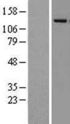 Western Blot: Lysine (K)-specific Demethylase 4A/KDM4A/JMJD2A Overexpression Lysate [NBL1-12103]