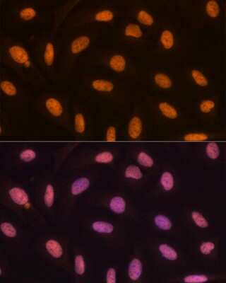 Immunocytochemistry/ Immunofluorescence: JMJD2B Antibody (8I0I1) [NBP3-16639]