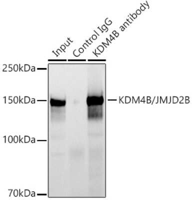 Immunoprecipitation: JMJD2B Antibody (8I0I1) [NBP3-16639]