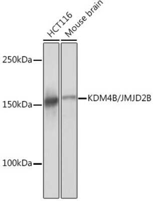 Western Blot: JMJD2B Antibody (8I0I1) [NBP3-16639]