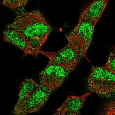 Immunocytochemistry/ Immunofluorescence: JMJD2B Antibody [NBP2-56243]