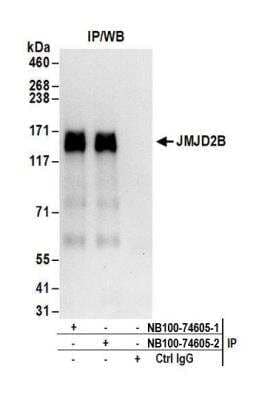 Immunoprecipitation: JMJD2B Antibody [NB100-74605]