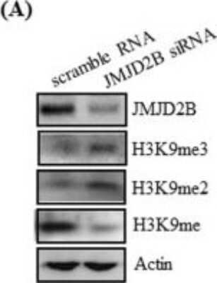 Knockdown Validated: JMJD2B Antibody [NB100-74605]