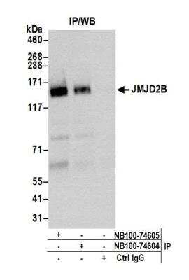 Immunoprecipitation: JMJD2B Antibody [NB100-74604]