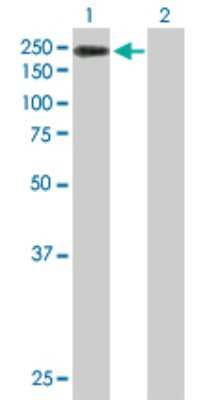 Western Blot: JMJD2B Antibody [H00023030-B01P]