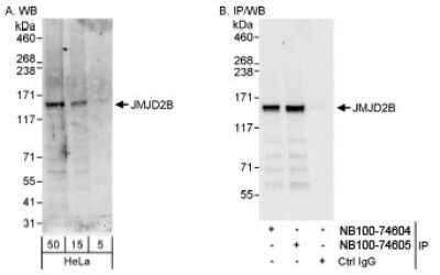 Western Blot: JMJD2B Antibody [NB100-74605]