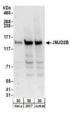 Western Blot: JMJD2B Antibody [NB100-74605]