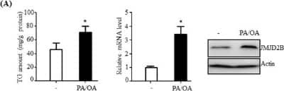 Western Blot: JMJD2B Antibody [NB100-74605]