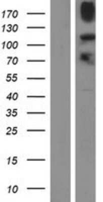 Western Blot: JMJD2B Overexpression Lysate [NBP2-10300]