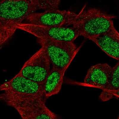 Immunocytochemistry/ Immunofluorescence: JMJD2D Antibody [NBP2-47413]